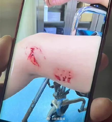 多名游客下海被不明生物咬伤！广西一地凌晨回应